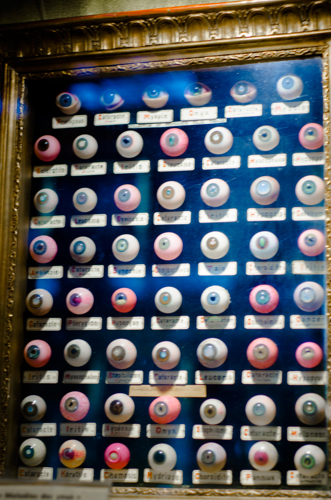 Visual interpretations of different eye problems